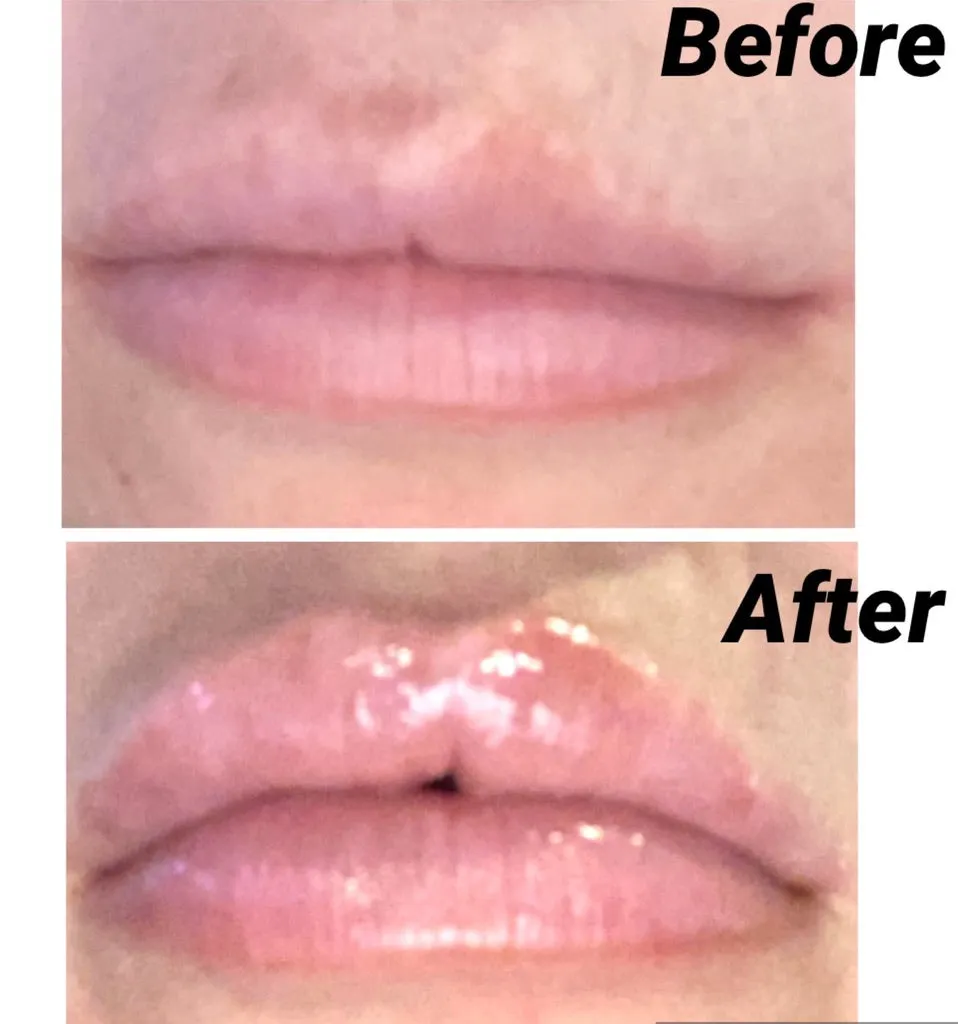 Gerard Kiss Assist Lip Plumper