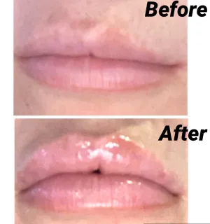 Gerard Kiss Assist Lip Plumper